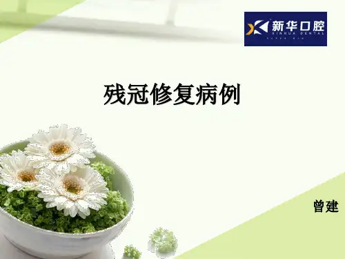 残冠修复病例