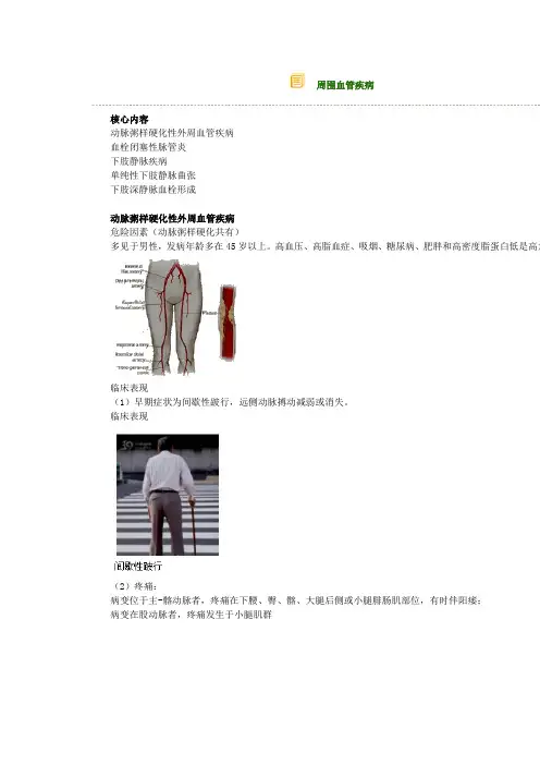 周围血管疾病 2