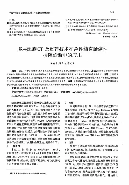 多层螺旋CT及重建技术在急性结直肠癌性梗阻诊断中的应用