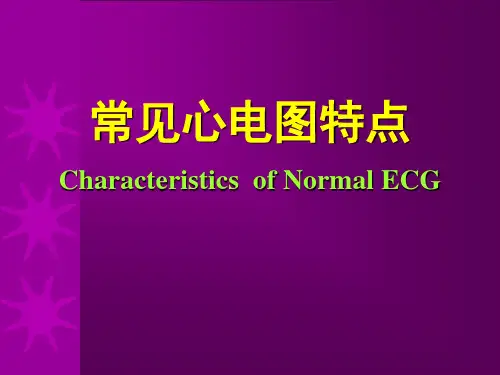 培训心电图课件