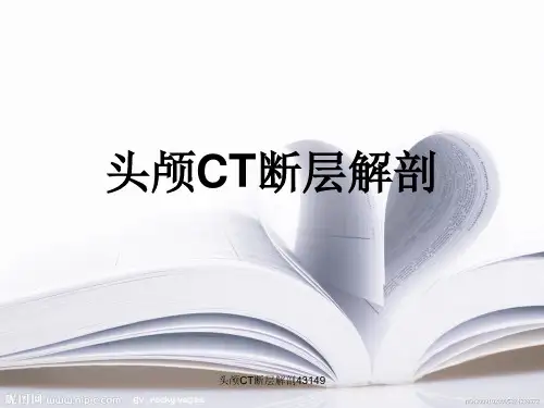 头颅CT断层解剖43149 ppt课件