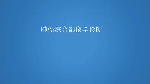影像学 肺癌的综合影像学诊断