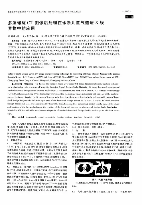 多层螺旋CT图像后处理在诊断儿童气道透X线异物中的应用