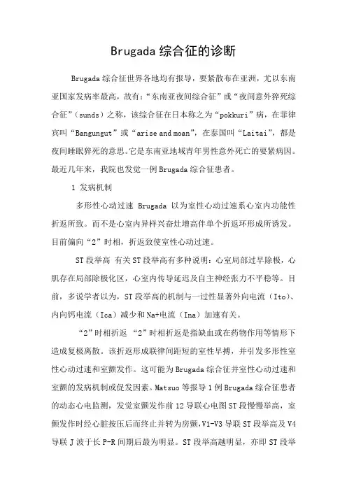Brugada综合征的诊断