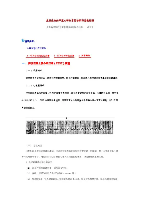 危及生命的严重心律失常的诊断和急救处理