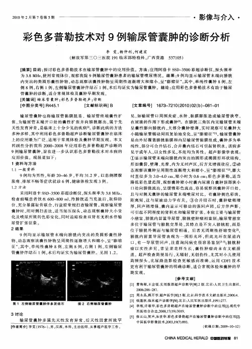 彩色多普勒技术对9例输尿管囊肿的诊断分析