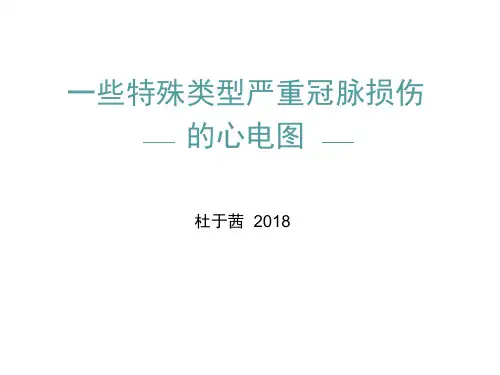 一些特殊类型严重冠脉病变的心电图