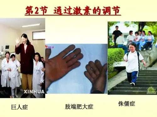 激素调节课件