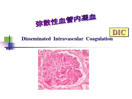 DIC精品PPT课件