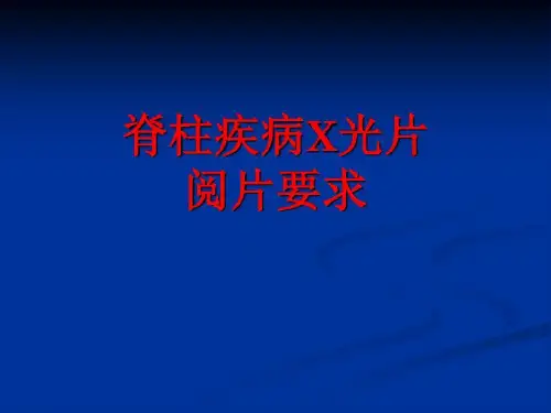 【医学PPT课件】脊柱疾病X光片阅片要求共47页文档