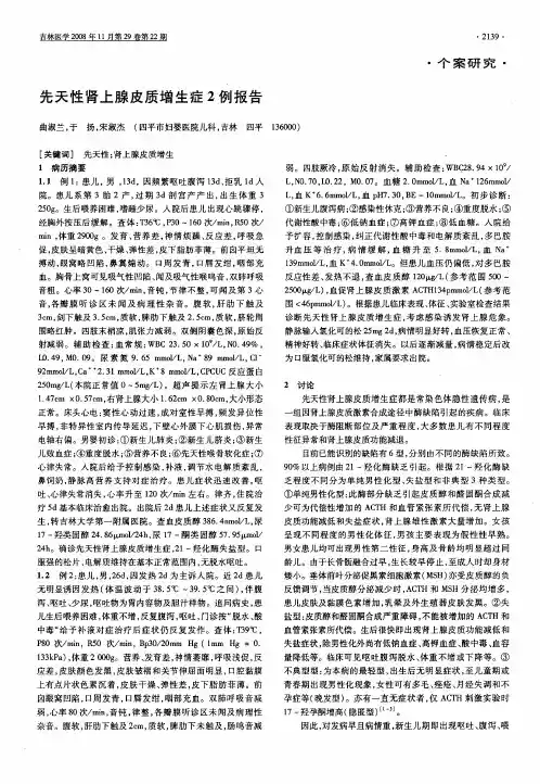 先天性肾上腺皮质增生症2例报告