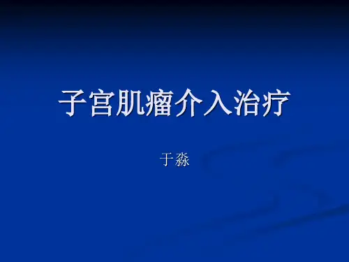 子宫肌瘤介入治疗