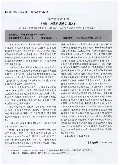 蕈样霉菌病1例