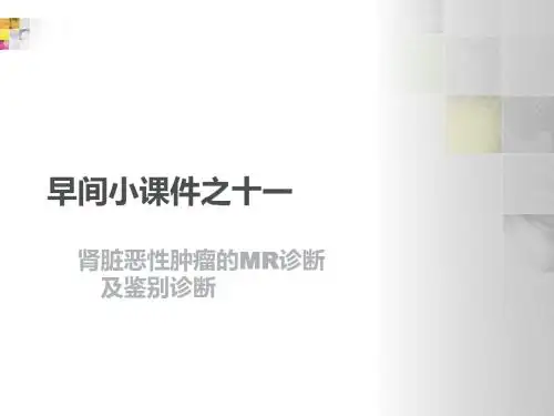 肾脏恶性肿瘤的诊断及鉴别诊断  ppt课件