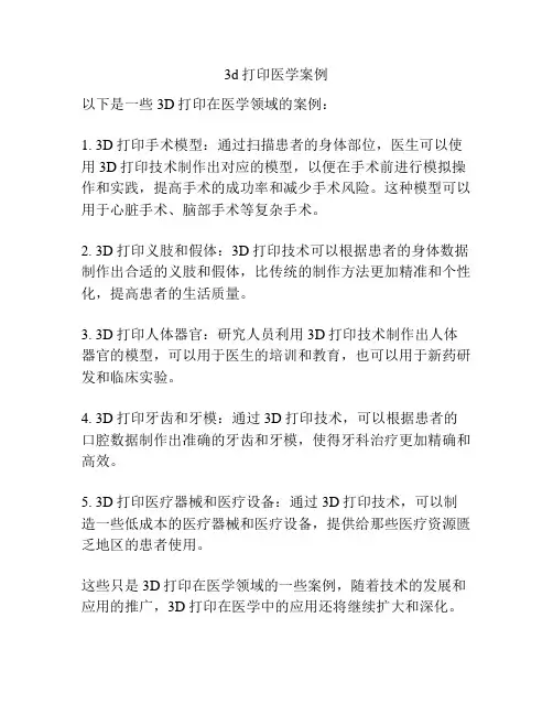 3d打印医学案例