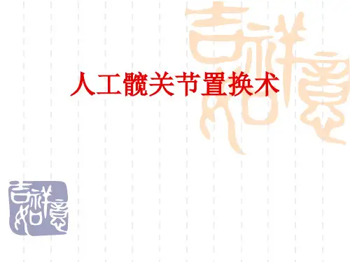人工髋关节置换术
