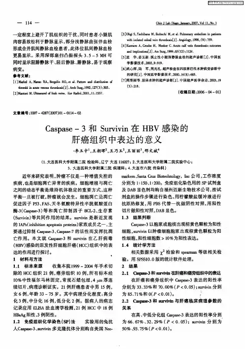 Caspase-3和Survivin在HBV感染的肝癌组织中表达的意义