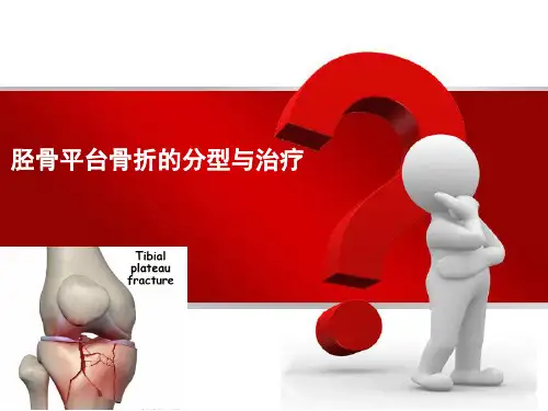 胫骨平台骨折的分型与治疗精品PPT课件 (2)
