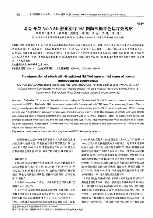调Q开关Nd：YAG激光治疗165例颧部褐青色痣疗效观察