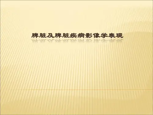 脾脏及脾脏疾病影像学表现