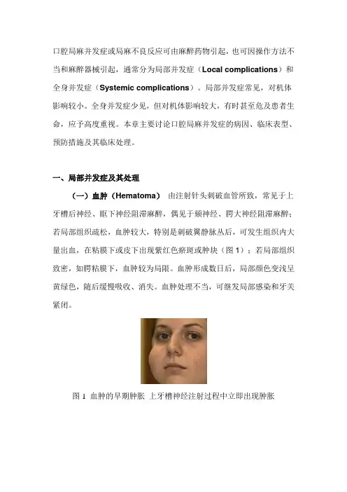 口腔局部麻醉并发症及临床处理 (2)