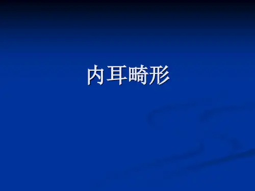 内耳畸形
