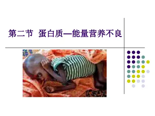蛋白质—能量营养不良