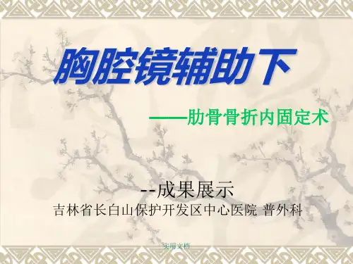 胸腔镜辅助下肋骨骨折内固定术