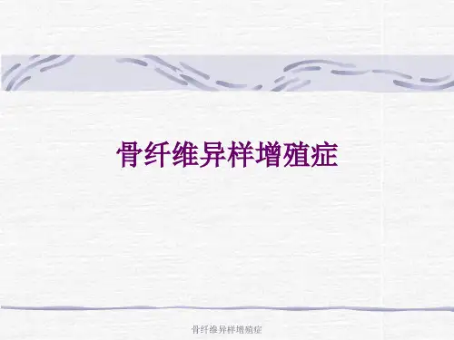 骨纤维异样增殖症 ppt课件
