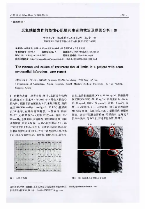 反复抽搐发作的急性心肌梗死患者的救治及原因分析1例