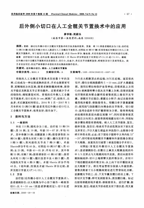 后外侧小切口在人工全髋关节置换术中的应用