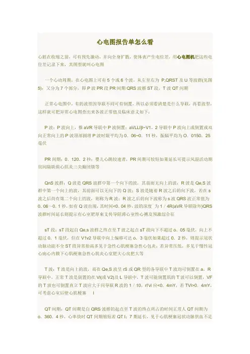 心电图报告单怎么看