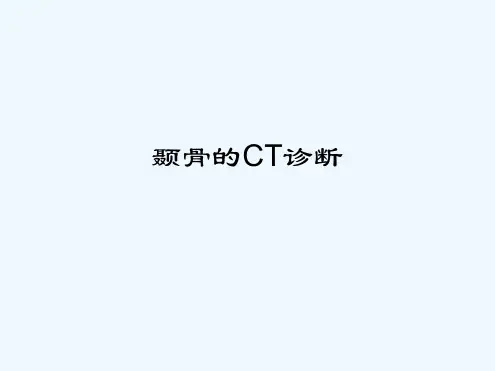 颞骨的CT解剖及诊断