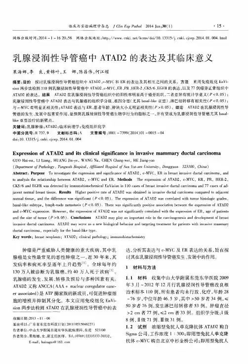 乳腺浸润性导管癌中ATAD2的表达及其临床意义