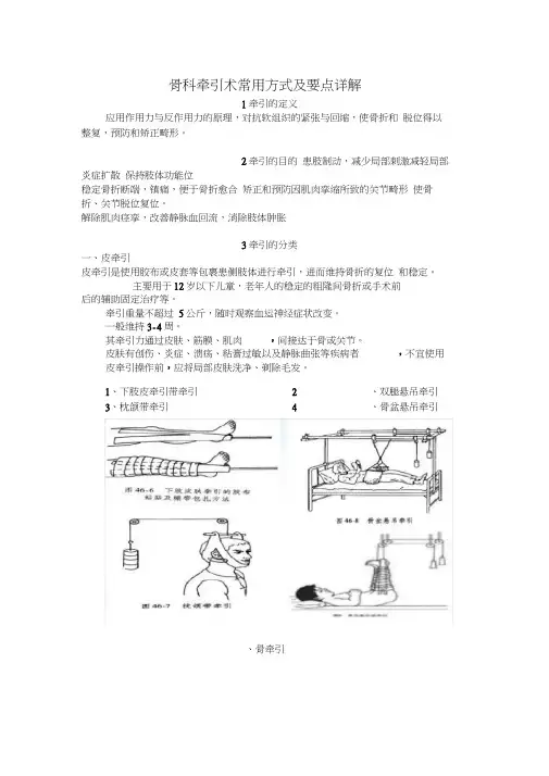 骨科牵引术常用方式及要点详解word精品