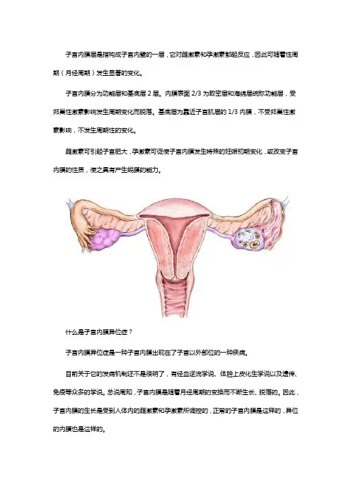 子宫内膜异位症的原因及危害是什么？