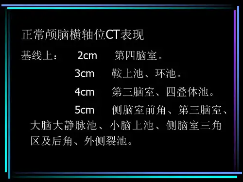 头颅ct解剖 ppt课件