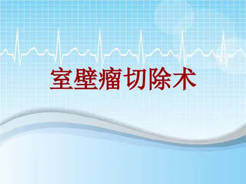 手术讲解模板:室壁瘤切除术