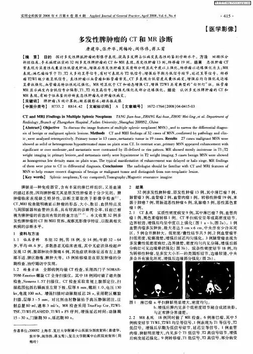 多发性脾肿瘤的CT和MR诊断