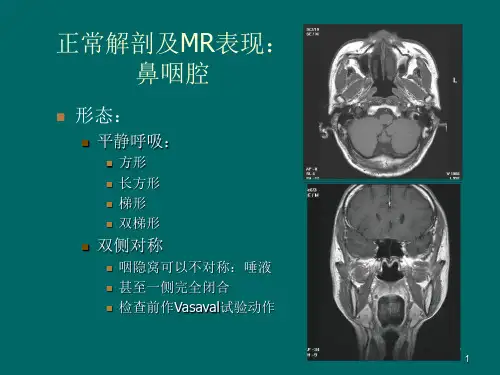 鼻咽癌MR诊断  2018