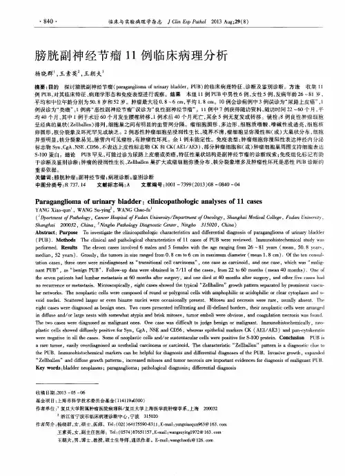 膀胱副神经节瘤11例临床病理分析