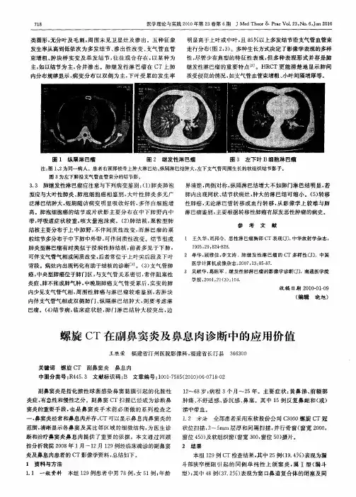 螺旋CT在副鼻窦炎及鼻息肉诊断中的应用价值