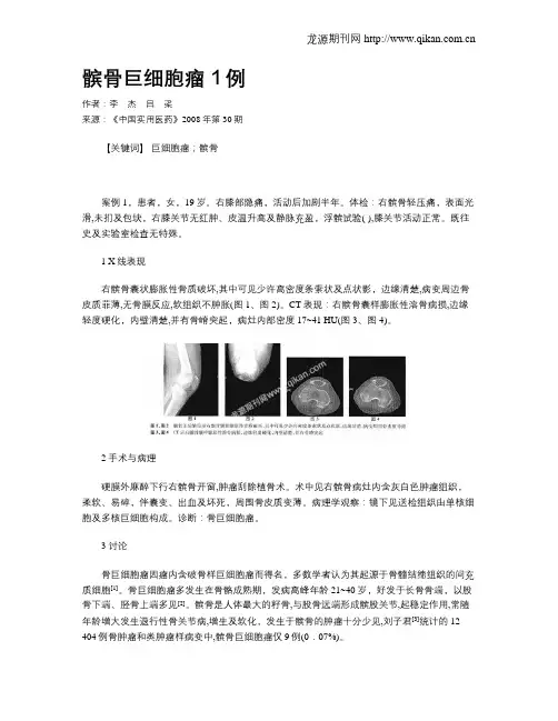 髌骨巨细胞瘤1例