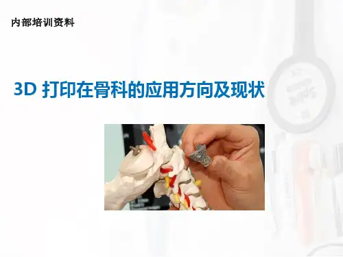 3D打印在骨科的应用方向及现状(精)