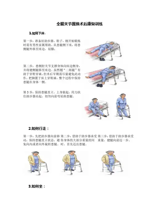 全髋关节置换术后康复训练