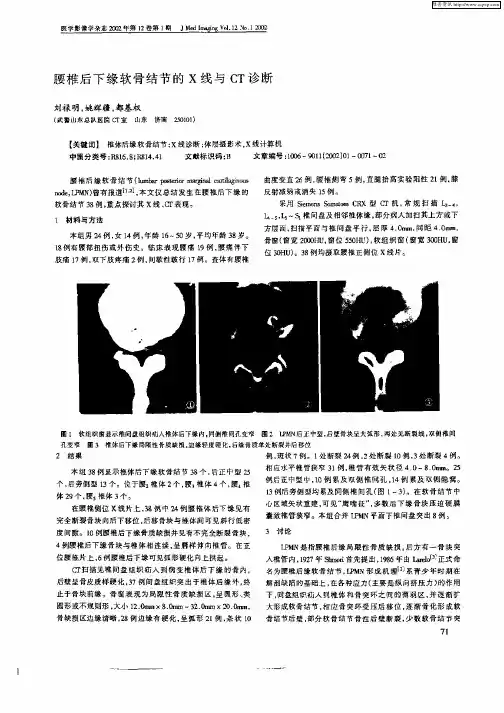 腰椎后下缘软骨结节的X线与CT诊断