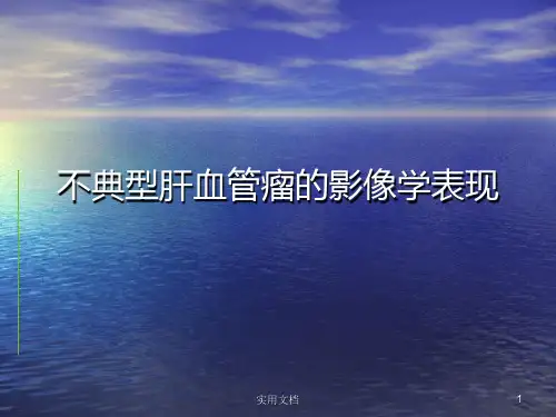 不典型肝血管瘤的影像学表现