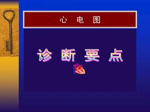 常见心电图诊断要点