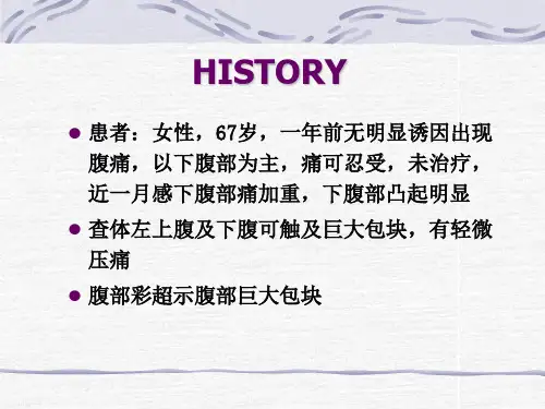 脂肪肉瘤一例CT表现