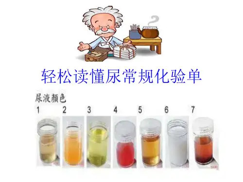 轻松看懂尿常规化验单ppt课件